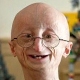 Sam Berns